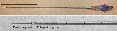 Tissue distribution of ethanol after intraprostatic injection using a porous needle